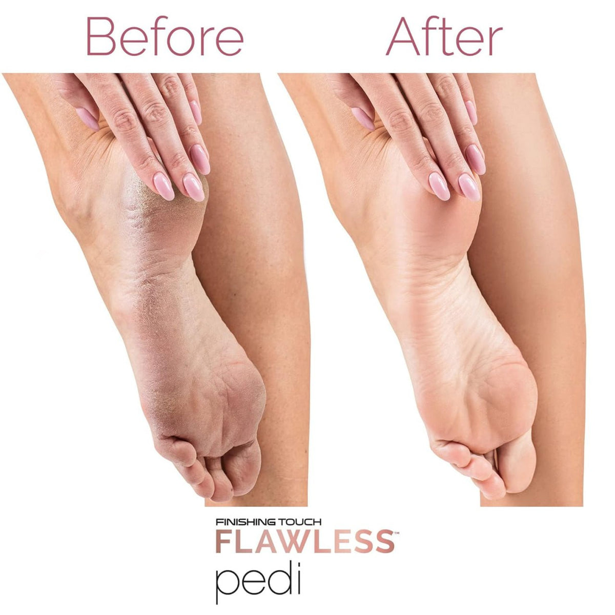 Flawless Pedi Electric Pedicure Machine